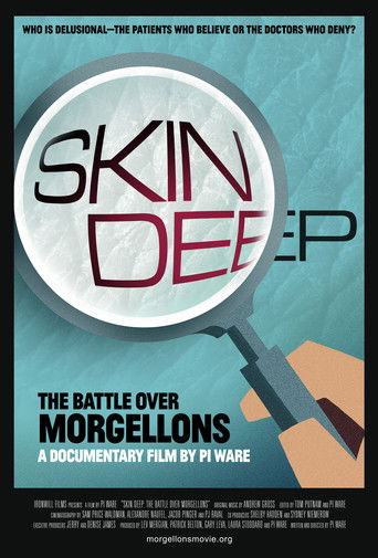 Skin Deep: The Battle Over Morgellons 2019